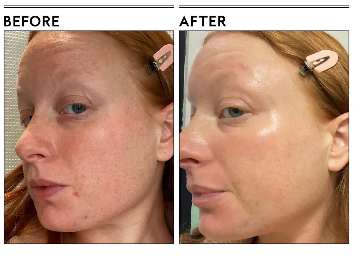Kit For Anty Aging