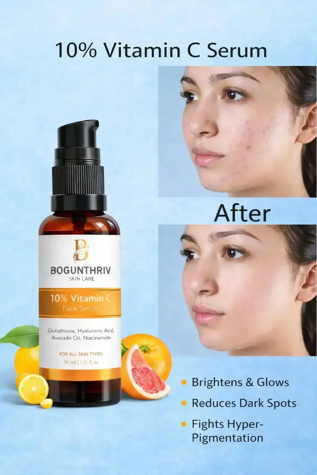 10% Vitamin C Serum – Glow Booster